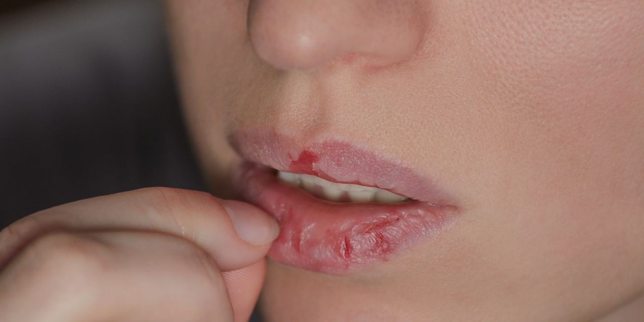 Penyebab Bibir Pecah-Pecah: Kebiasaan Basahi Bibir Di Ruang AC